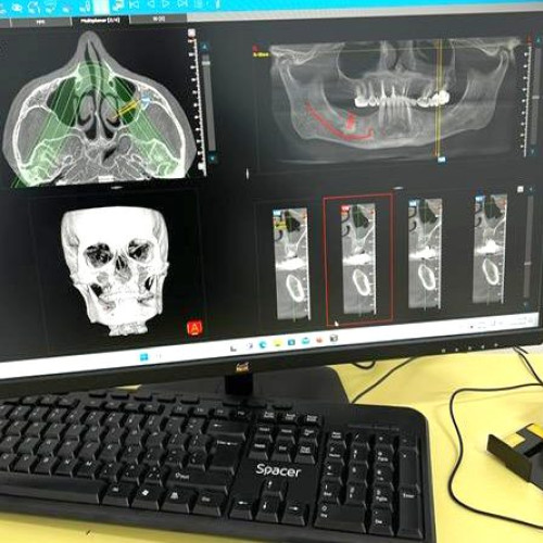 Rezolvarea unei probleme majore pentru Simeria: Radiografiile dentare sunt disponibile acum la Spitalul CF Simeria